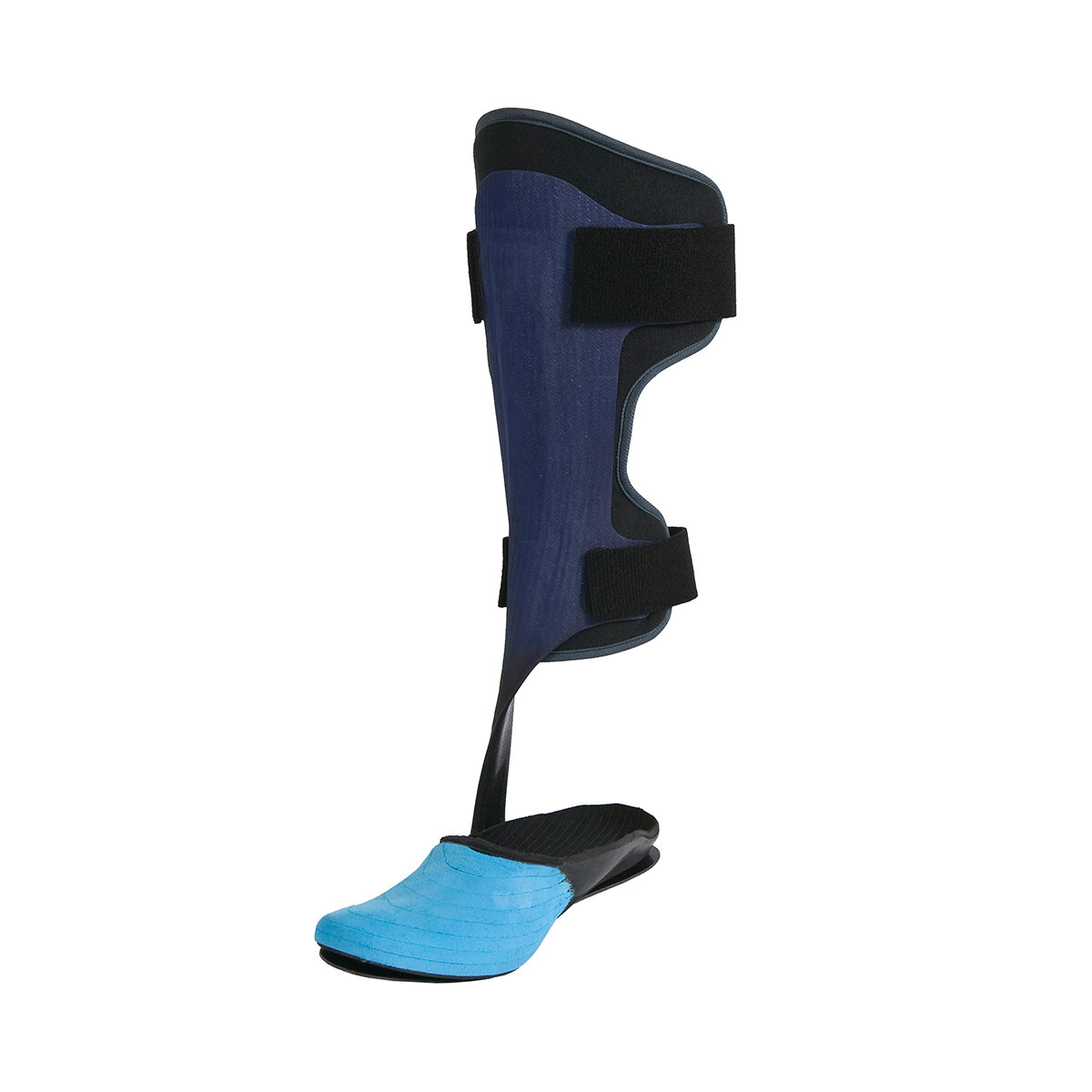 Allard Partial Foot Prosthesis