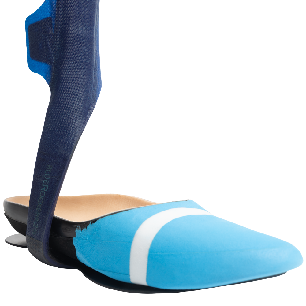 Allard Partial Foot Prosthesis