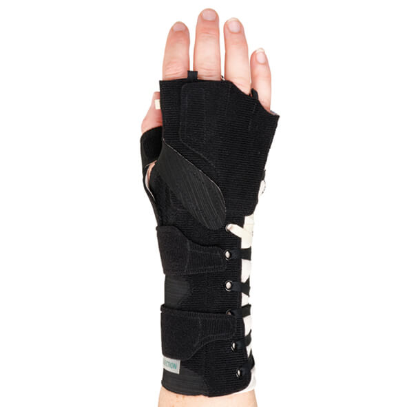 SELECTION Radialis Finger Part