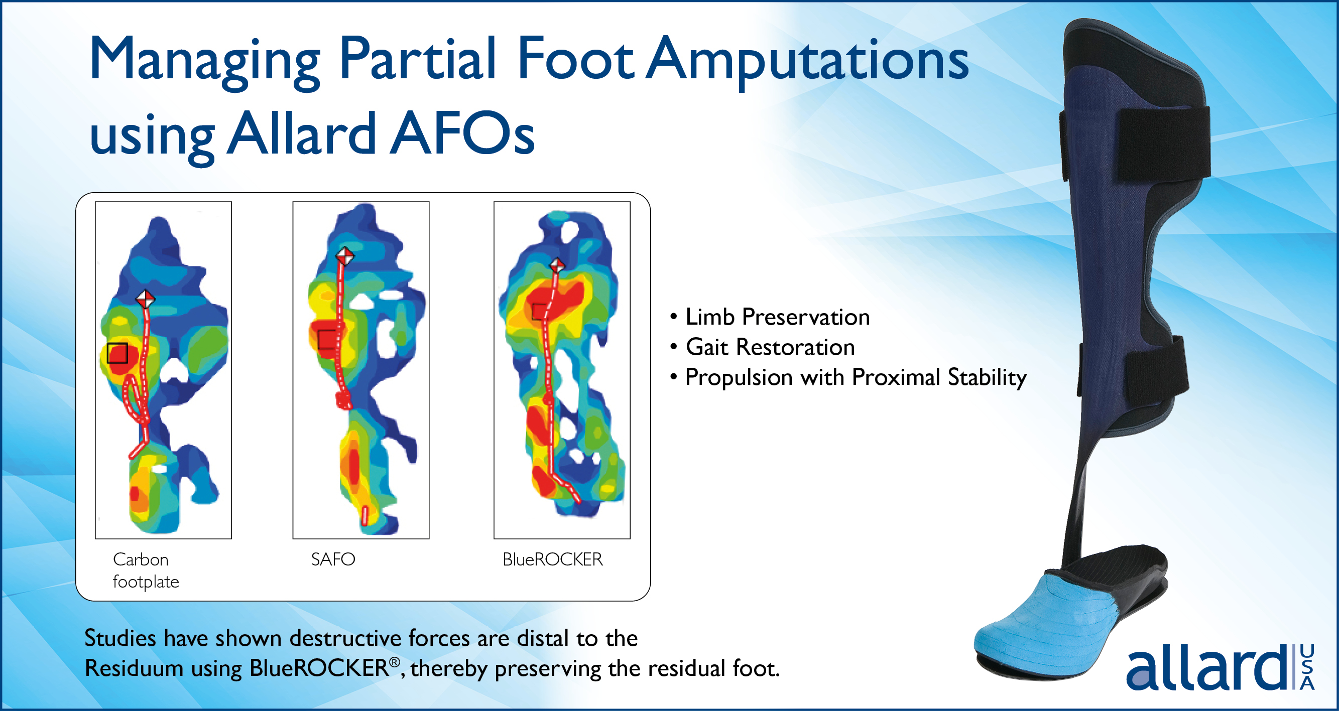 Managing Partial Foot Amputations Using Allard AFOs